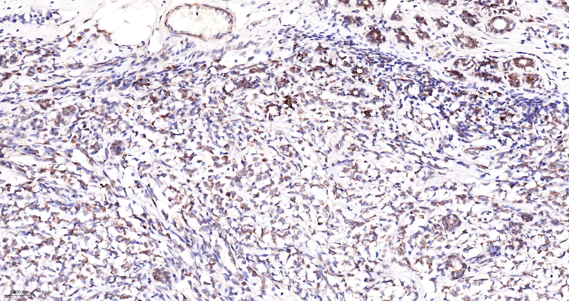 PCCB Monoclonal Antibody