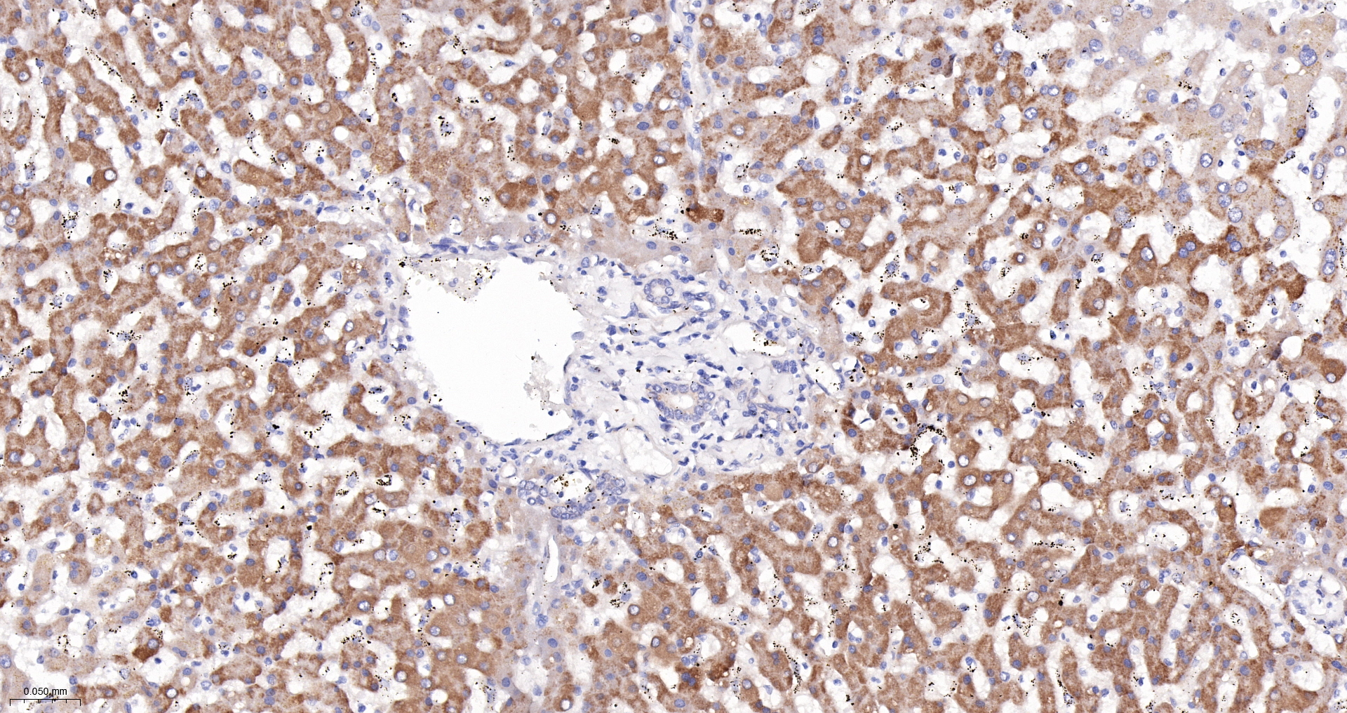 PCCB Monoclonal Antibody