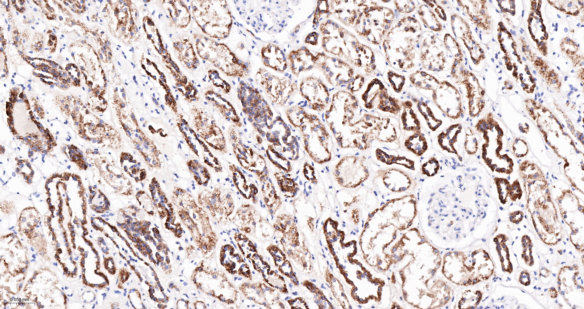 PCCB Monoclonal Antibody
