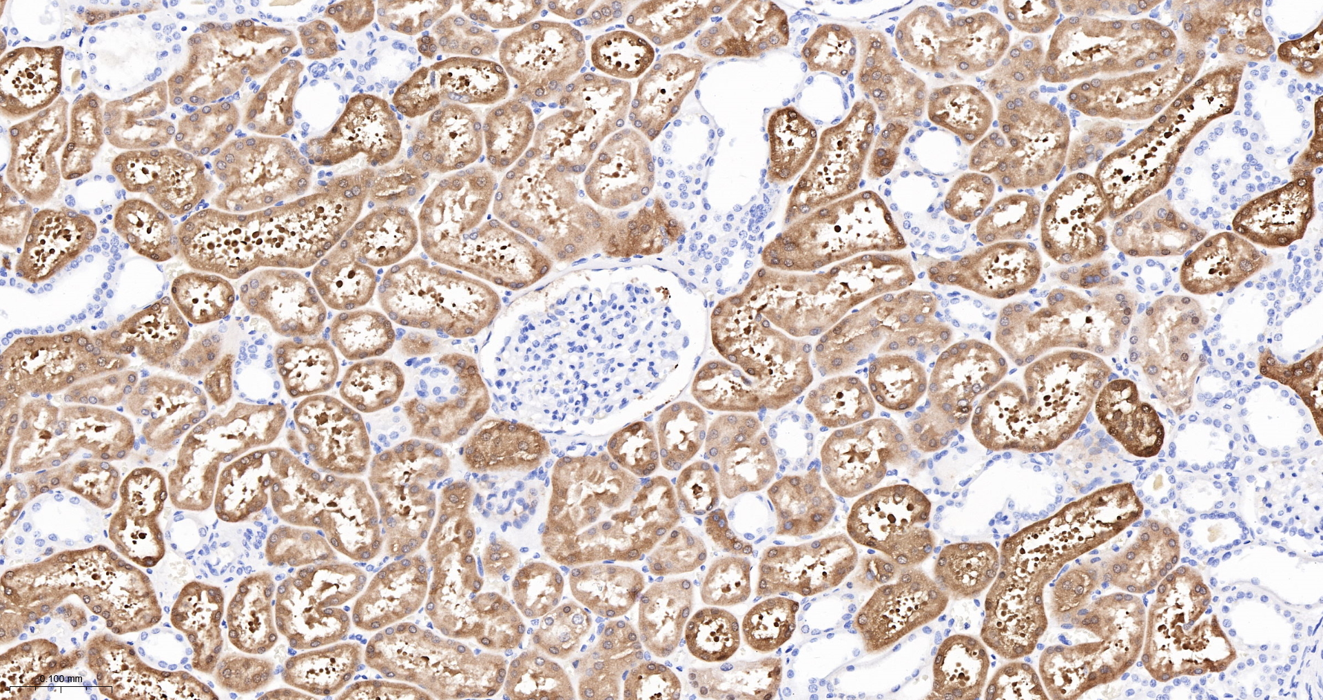 BHMT Recombinant Antibody