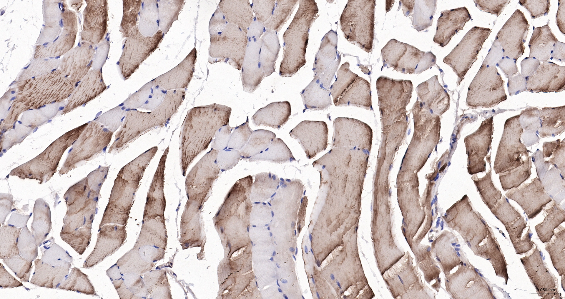 Parvalbumin Monoclonal Antibody