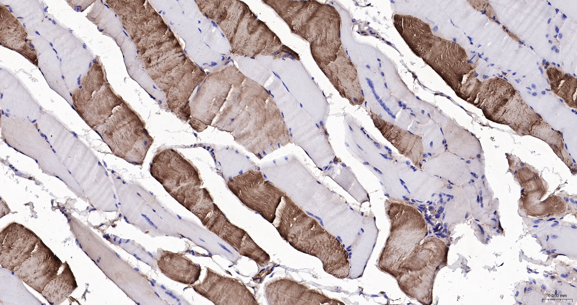 Parvalbumin Monoclonal Antibody