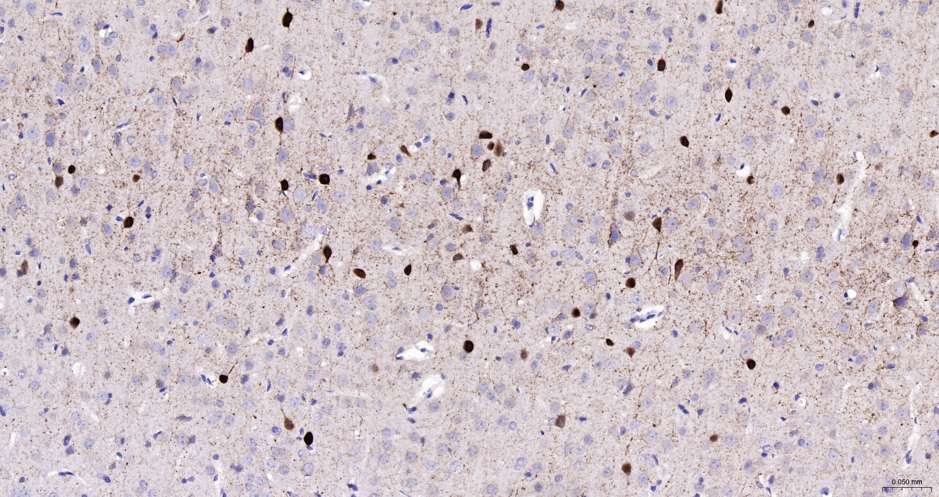 Parvalbumin Monoclonal Antibody