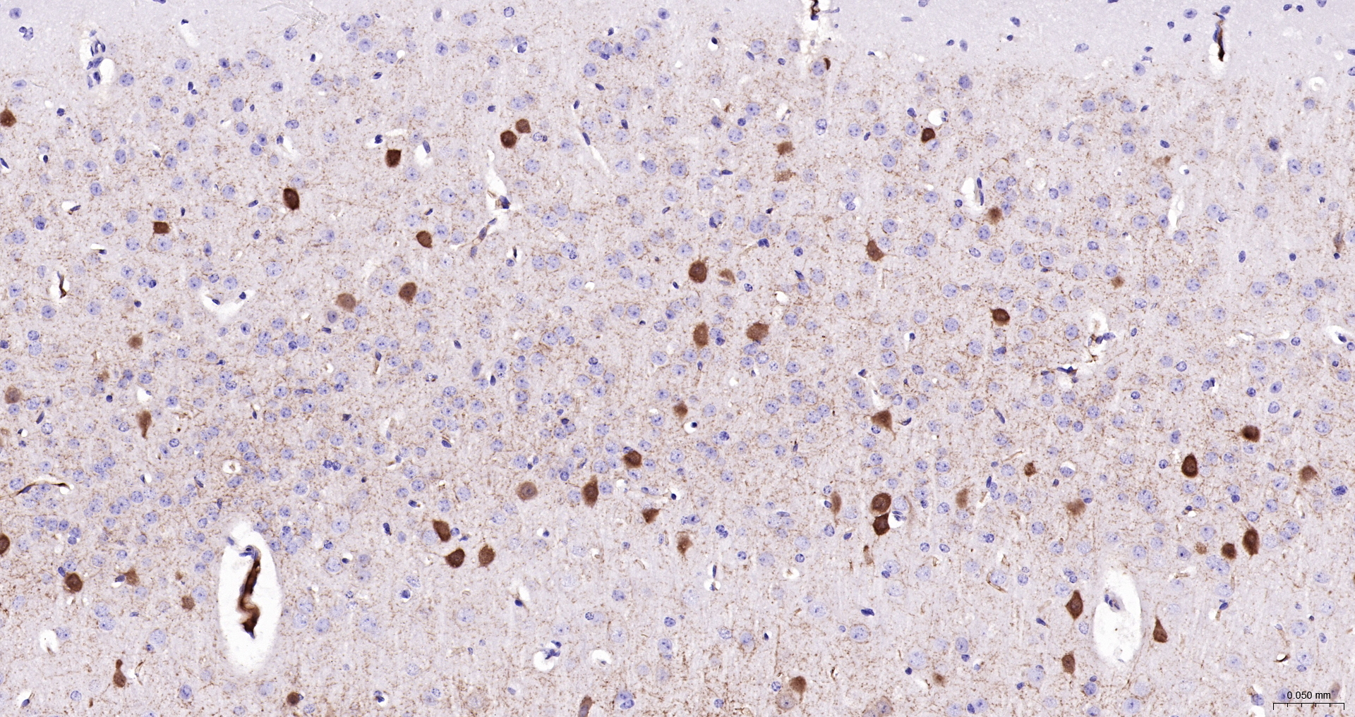 Parvalbumin Monoclonal Antibody