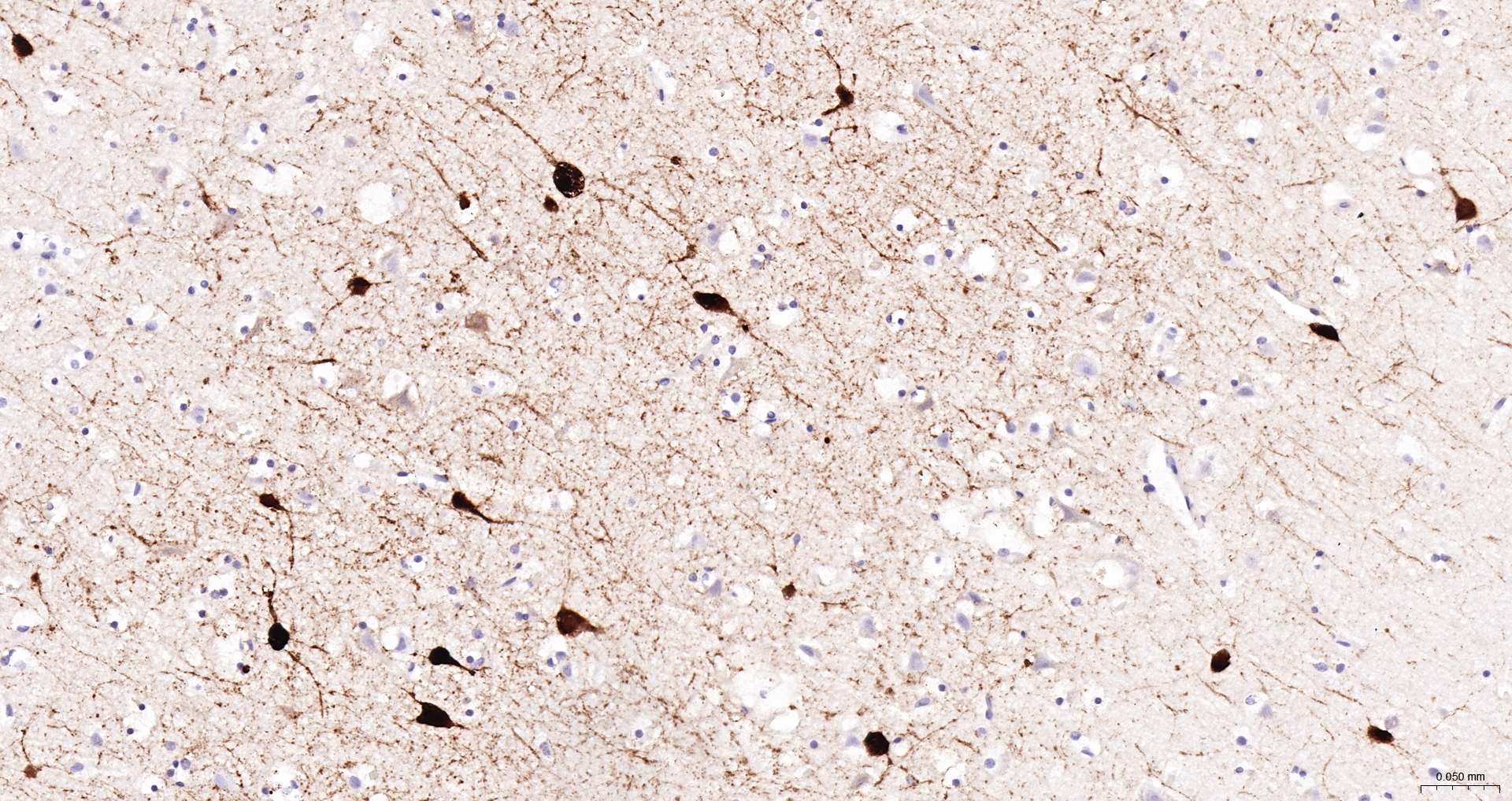 Parvalbumin Monoclonal Antibody
