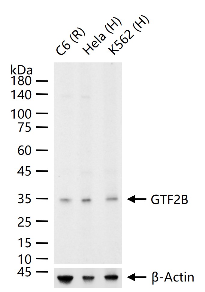 GTF2B Recombinant Antibody