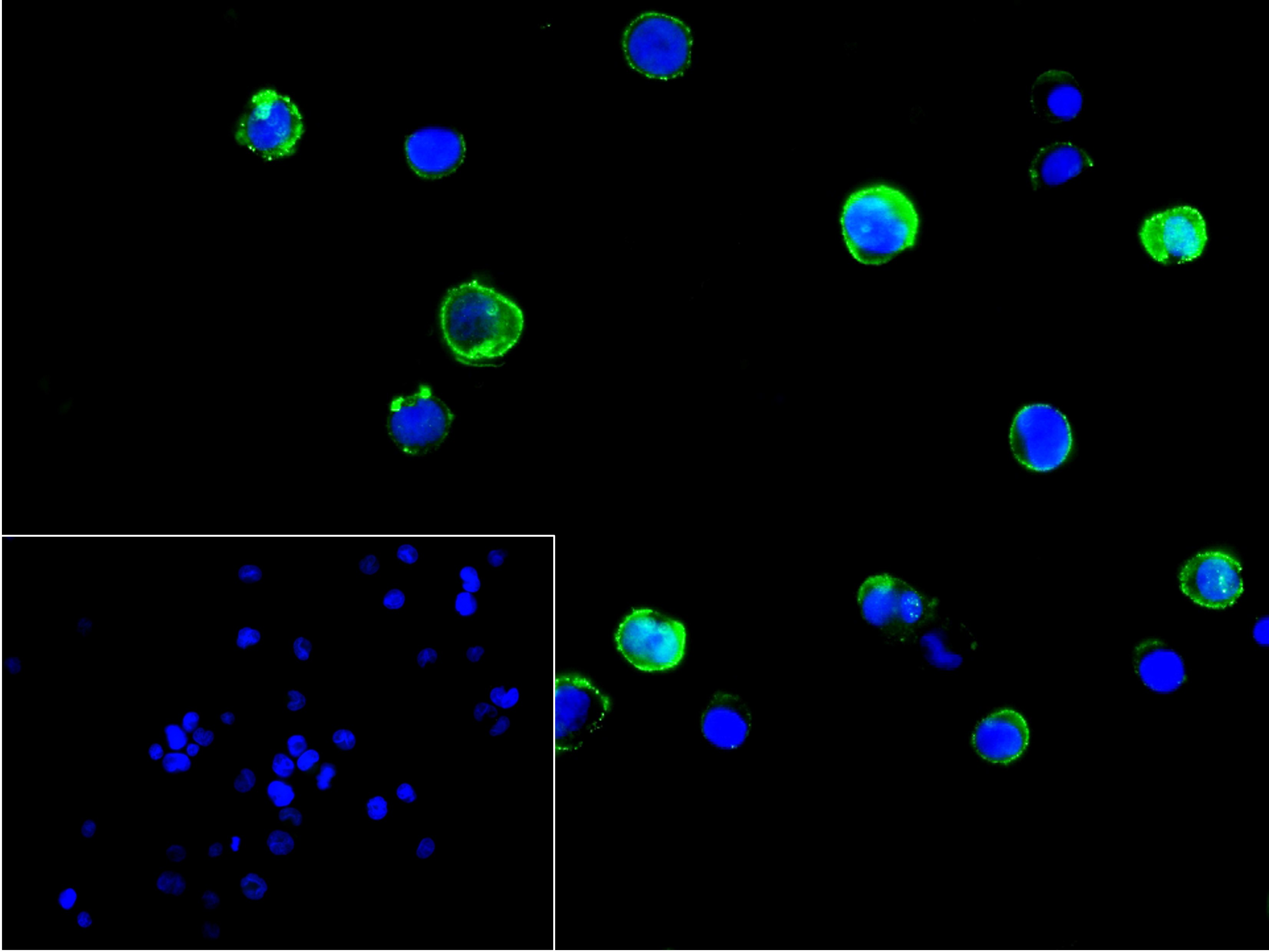 CD68 Monoclonal Antibody