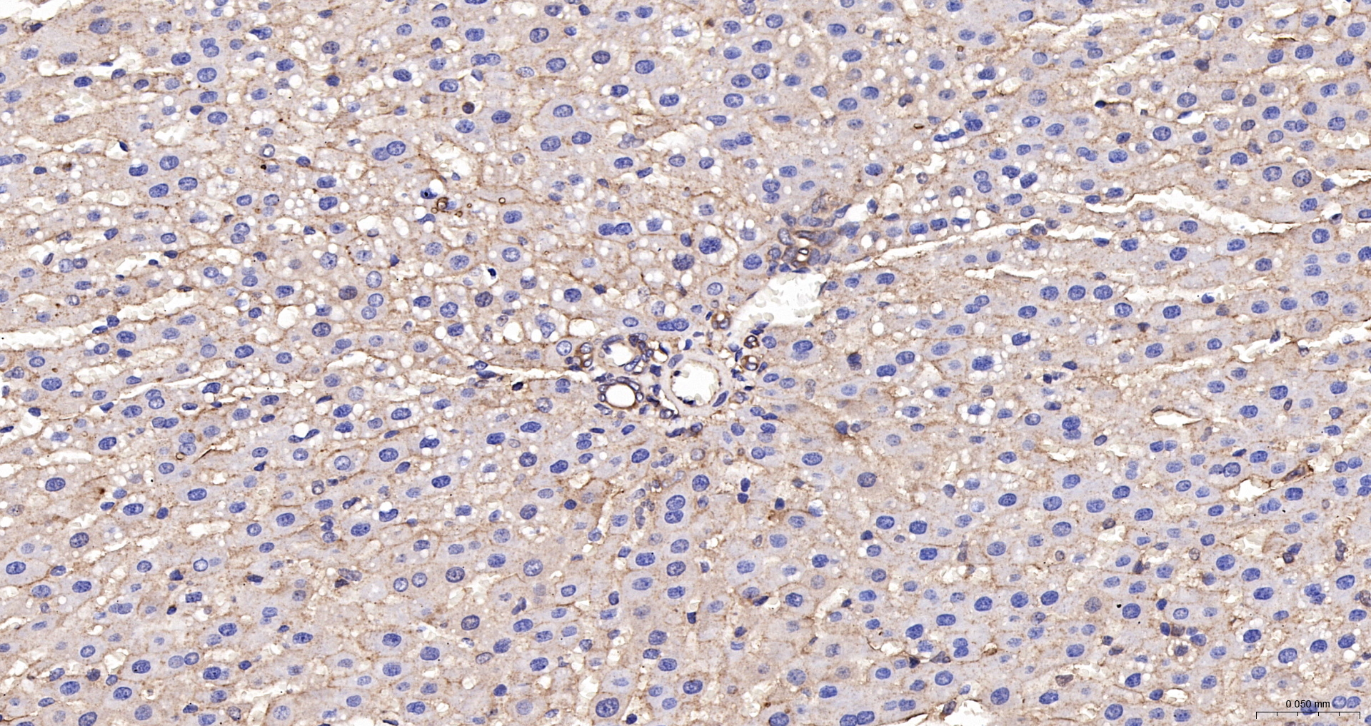 ANXA6 | ANX6 Polyclonal Antibody