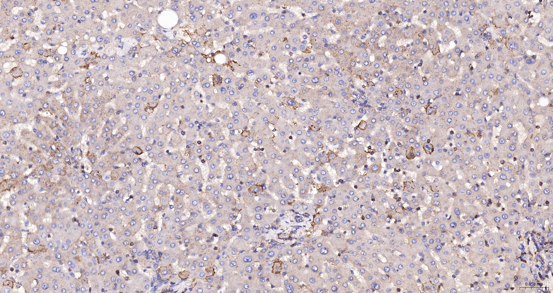 ANXA6 | ANX6 Polyclonal Antibody