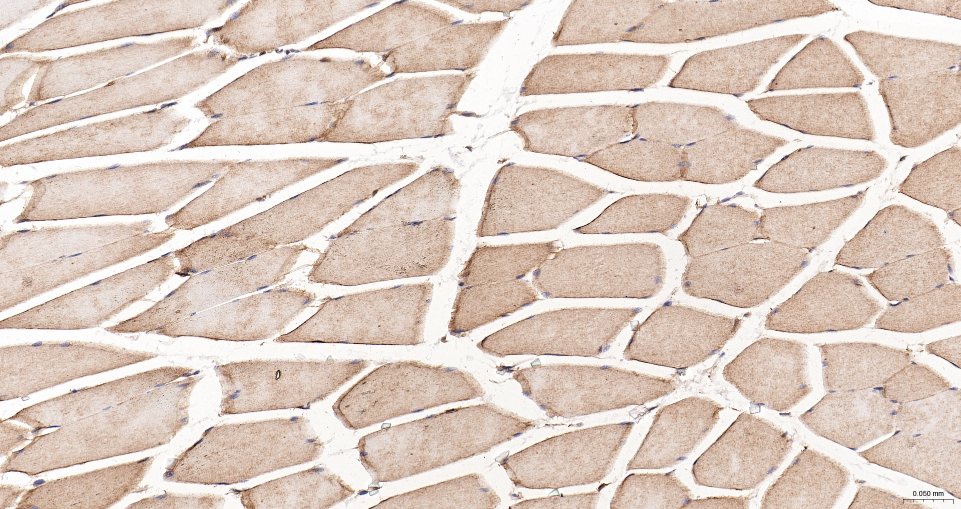 ANXA6 | ANX6 Polyclonal Antibody