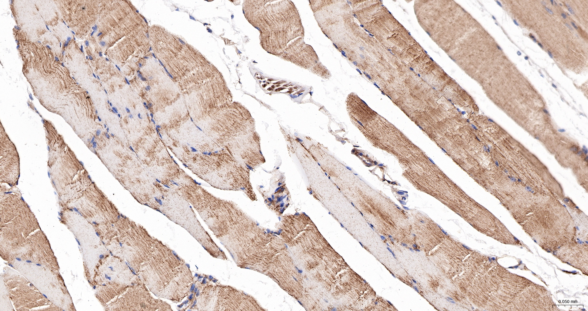 ANXA6 | ANX6 Polyclonal Antibody