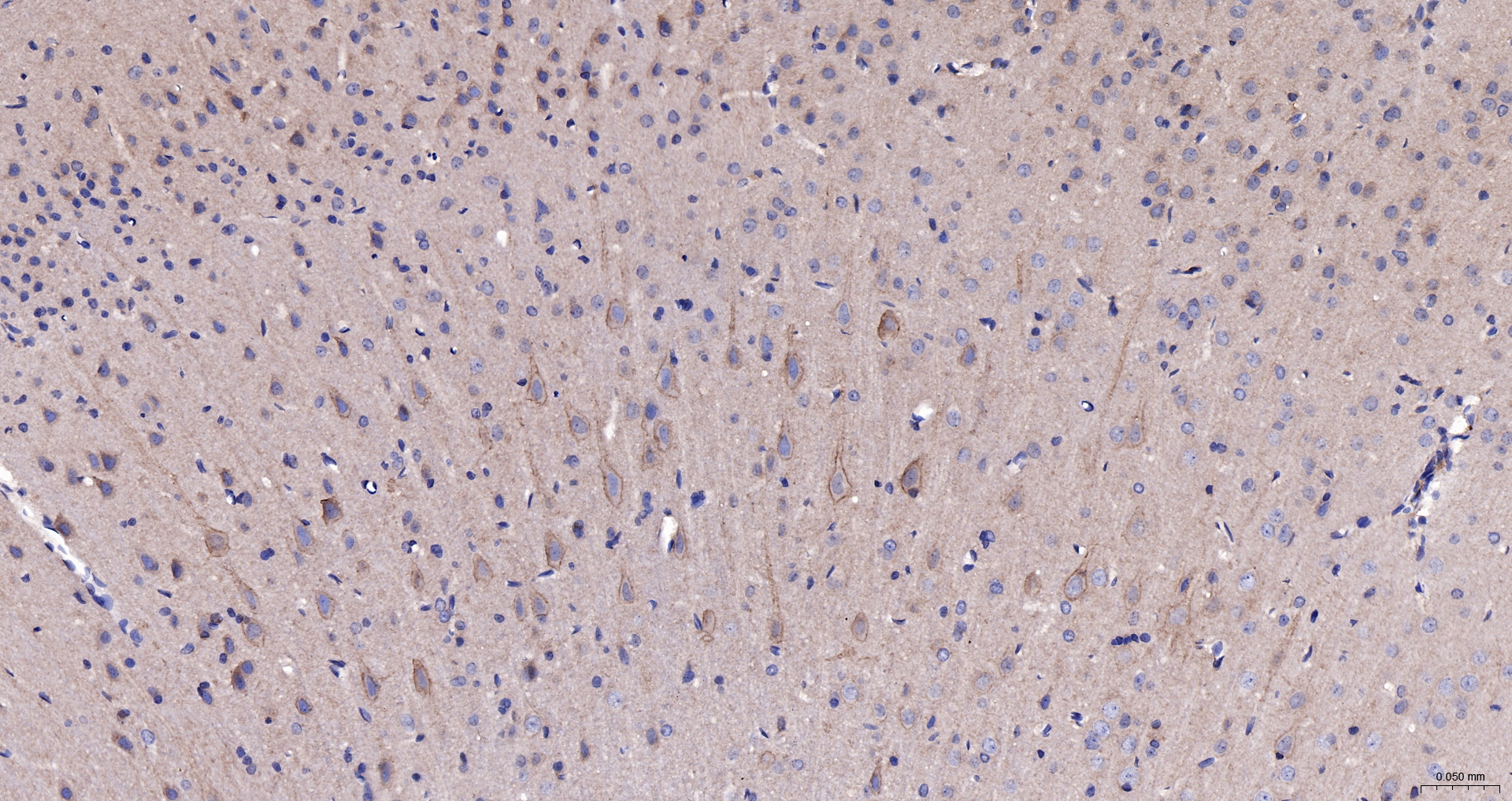 ANXA6 | ANX6 Polyclonal Antibody