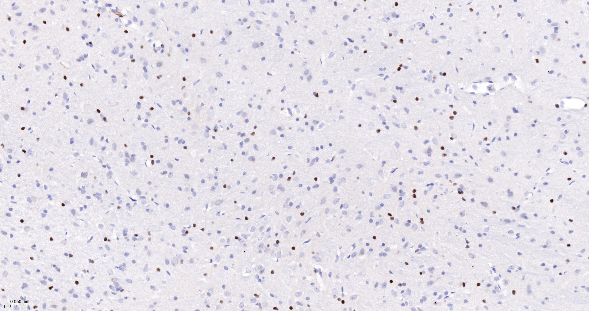 SOX2 Monoclonal Antibody