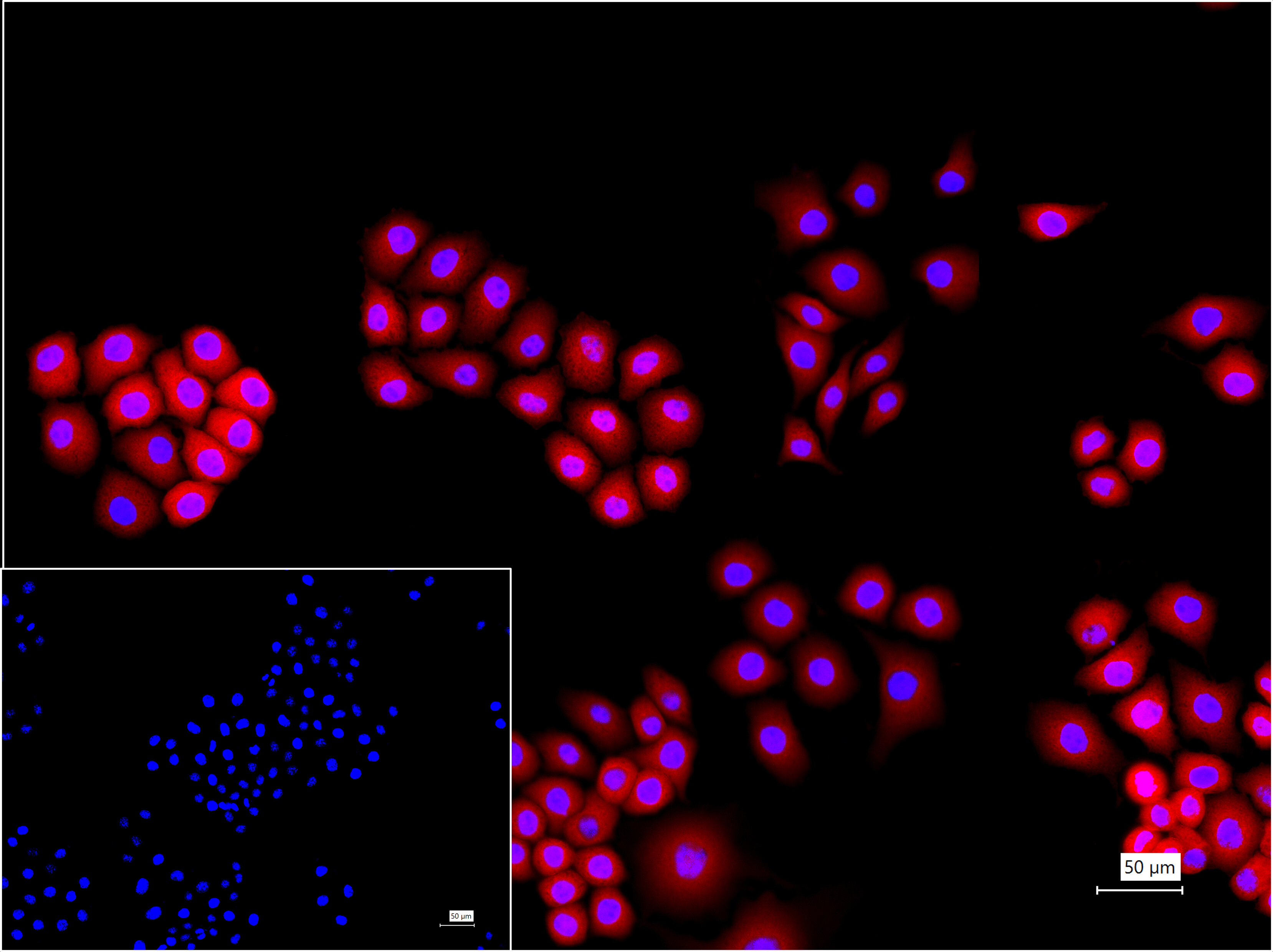 NFKB p65 Polyclonal Antibody, PE Conjugated