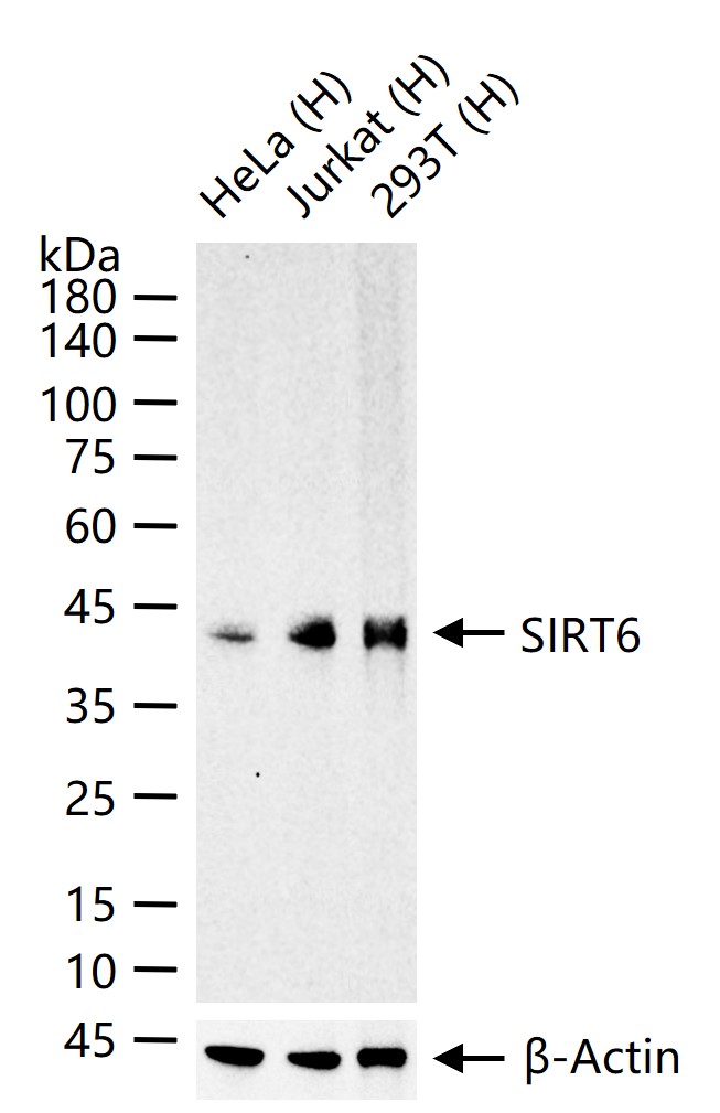 SIRT6 Recombinant Antibody