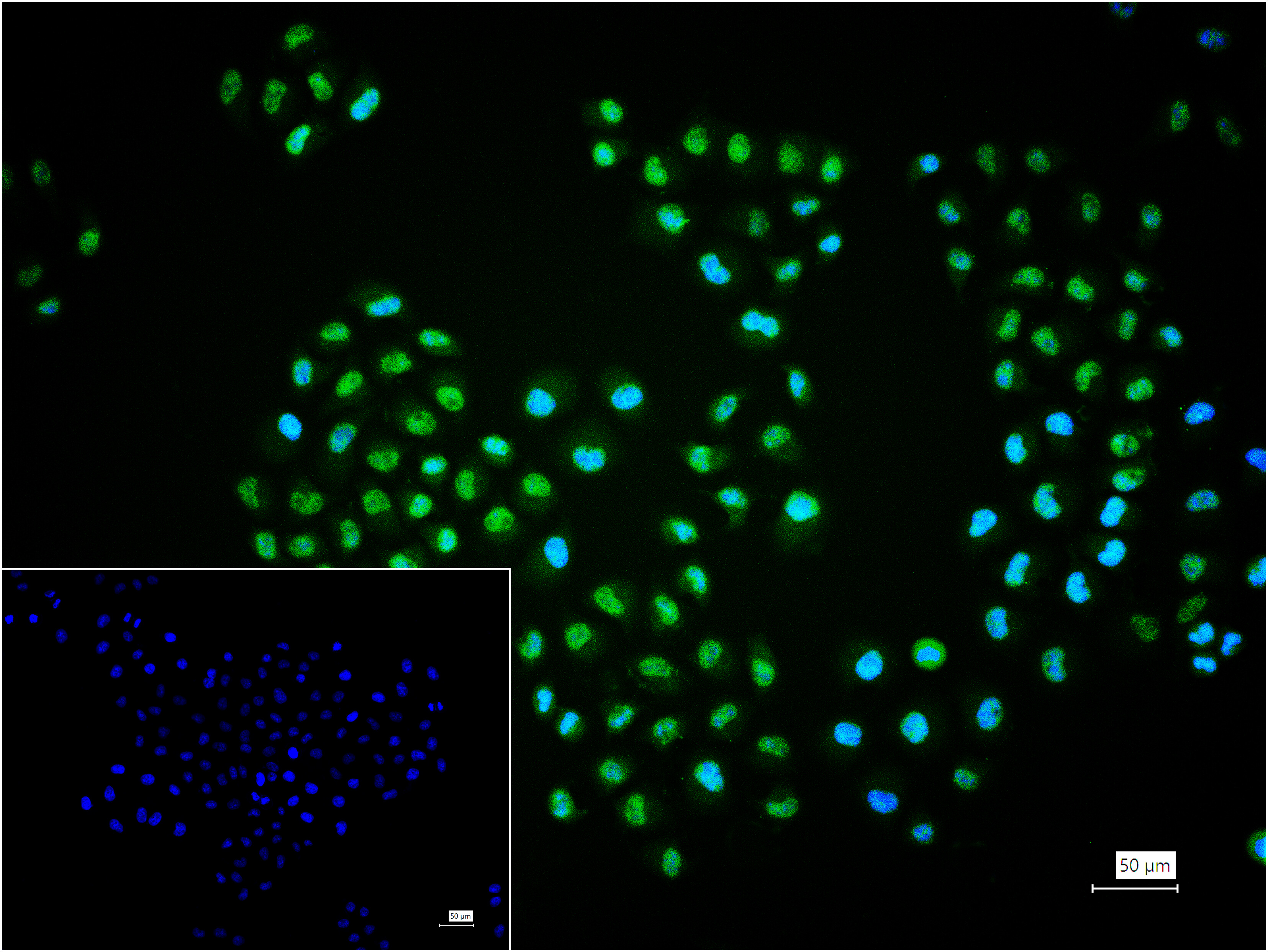 NKX2-1 Monoclonal Antibody