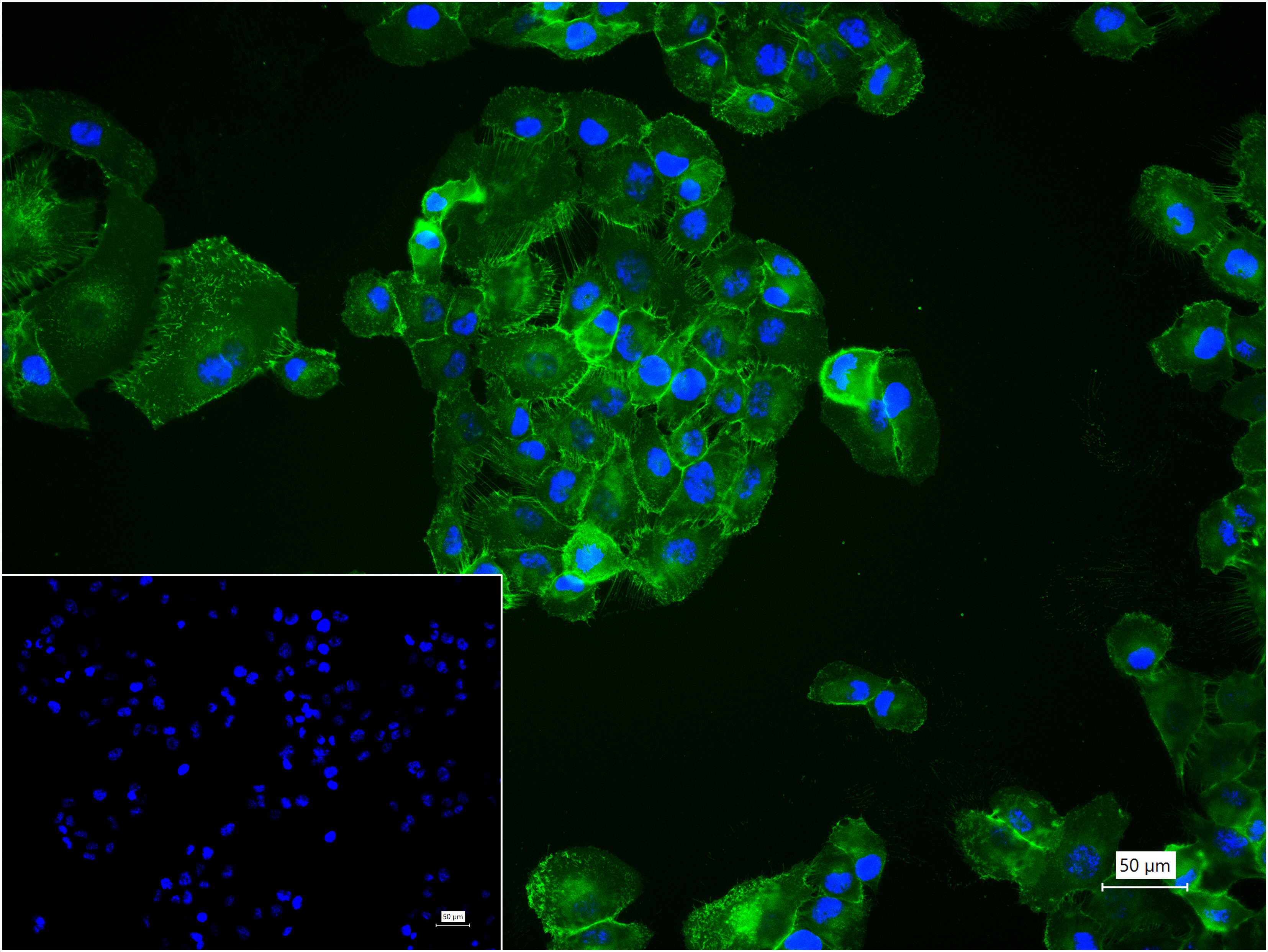 Integrin beta 1 Monoclonal Antibody