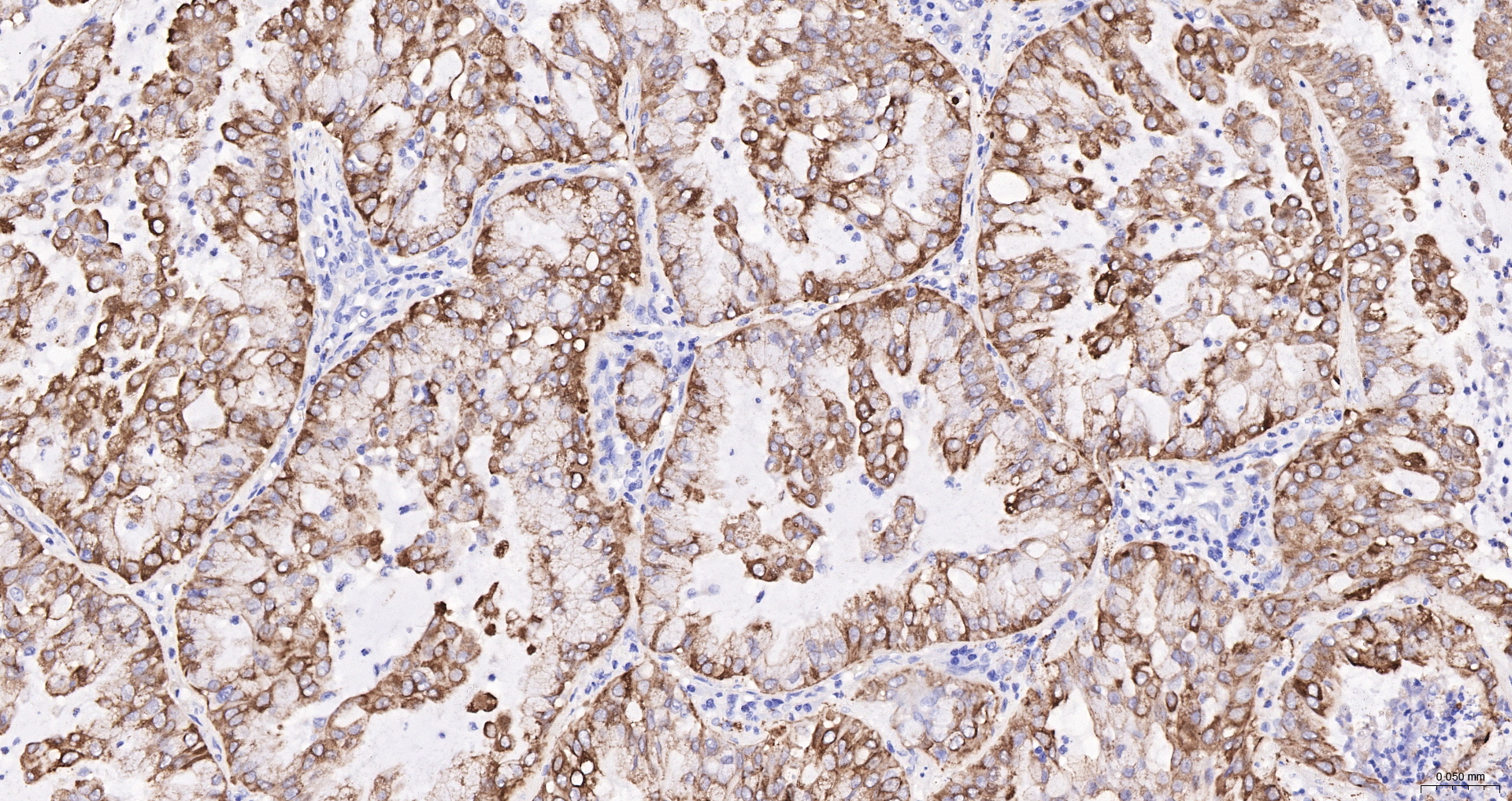 Cytokeratin 19 Recombinant Antibody