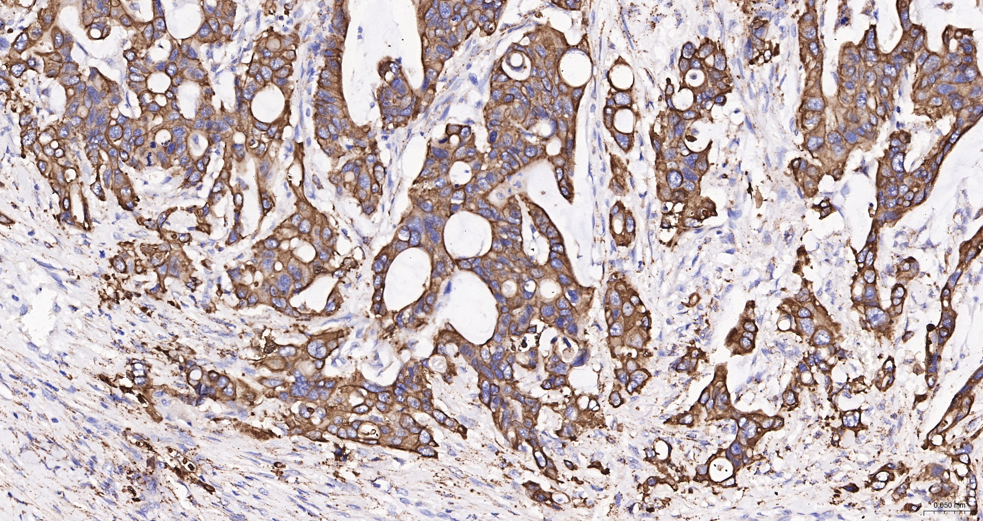 Cytokeratin 19 Recombinant Antibody