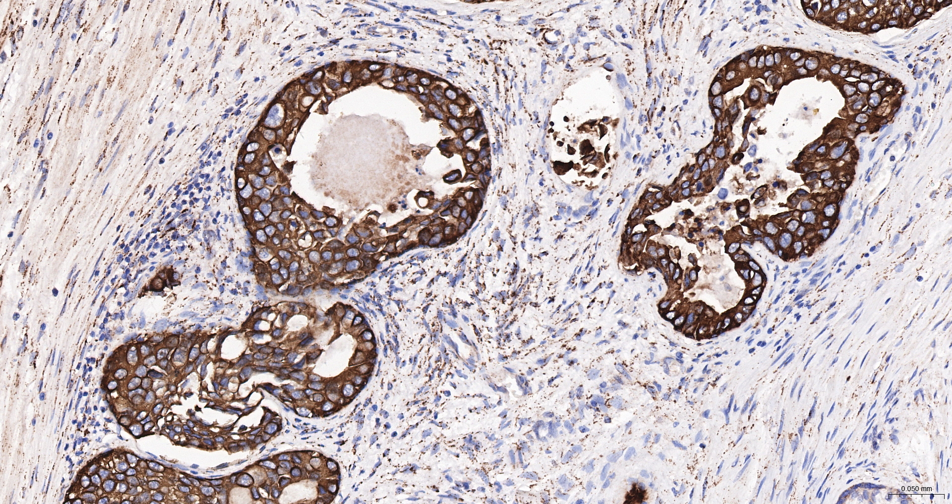 Cytokeratin 19 Recombinant Antibody