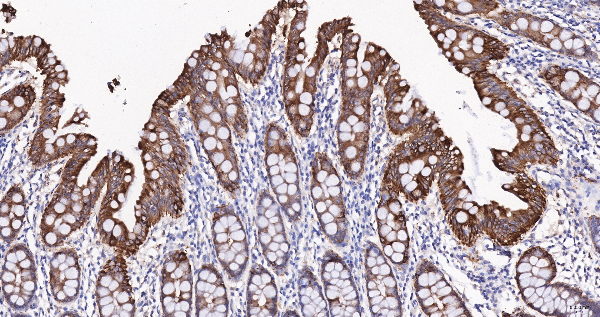 Cytokeratin 19 Recombinant Antibody