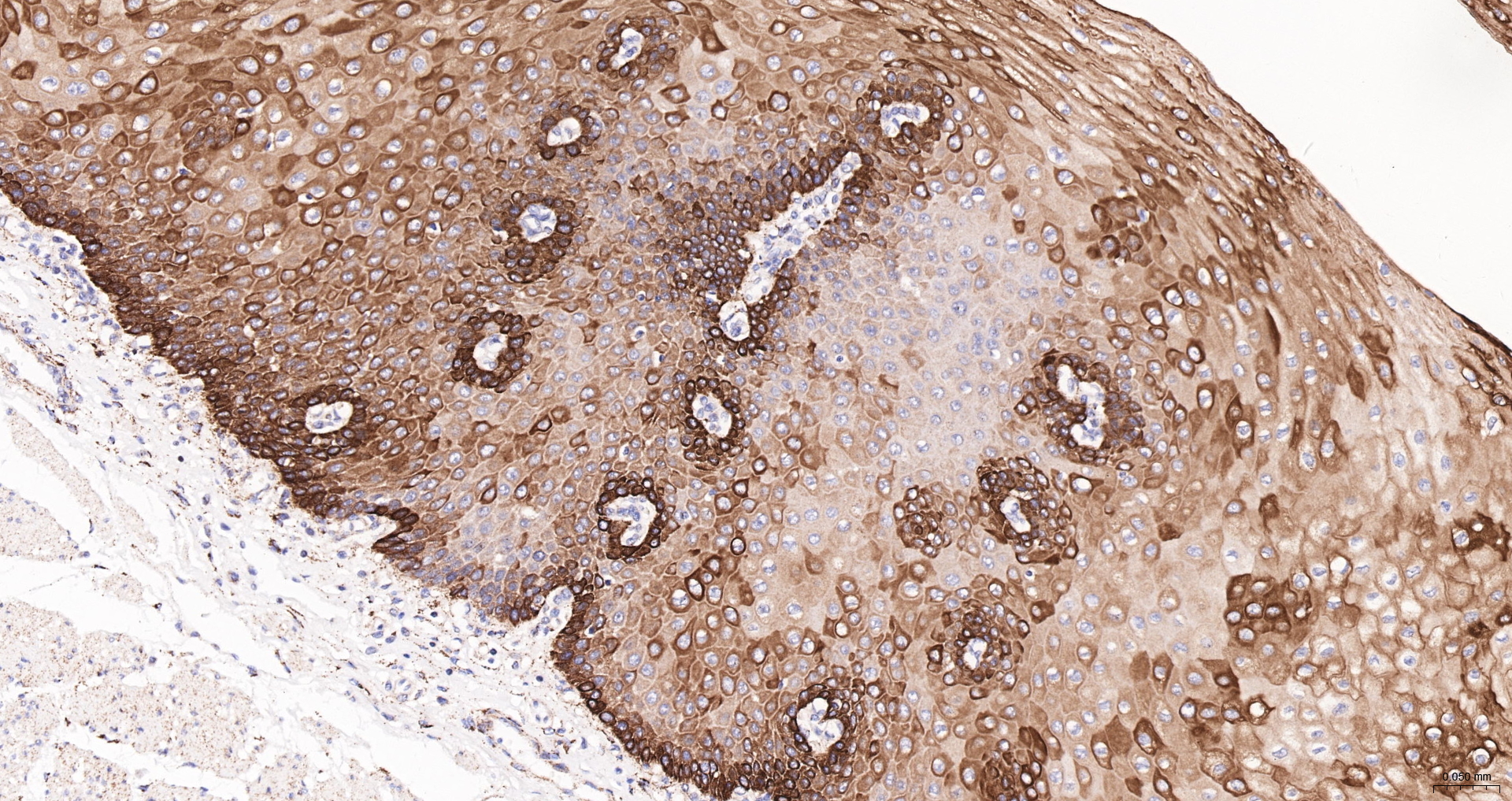 Cytokeratin 19 Recombinant Antibody