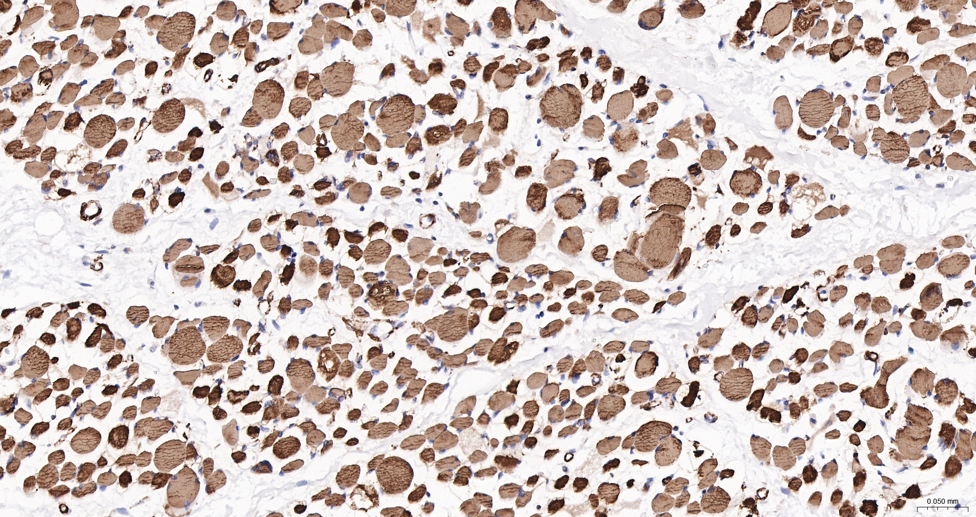 Actin, alpha skeletal muscle Recombinant Antibody