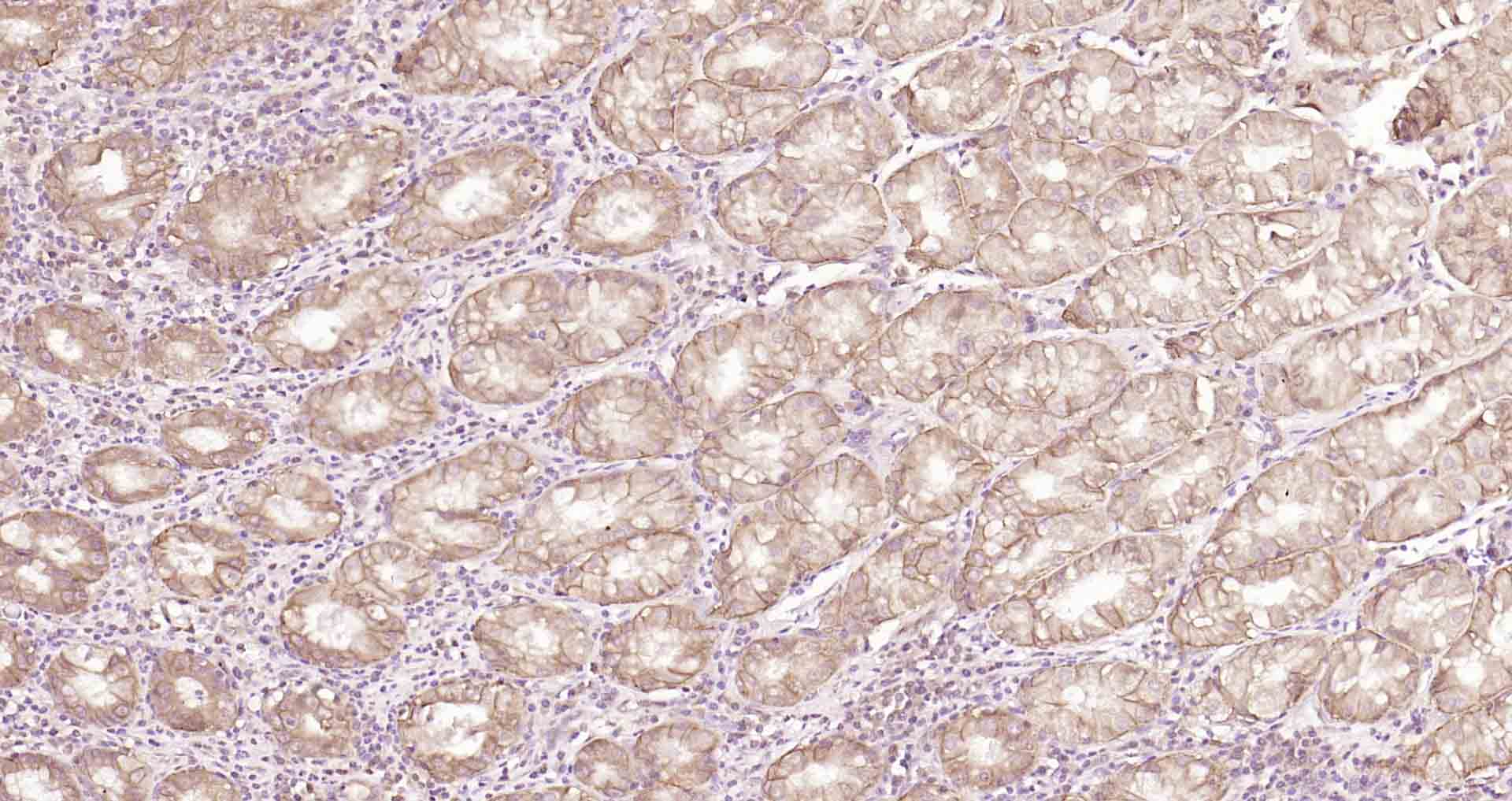 Claudin-18 Monoclonal Antibody