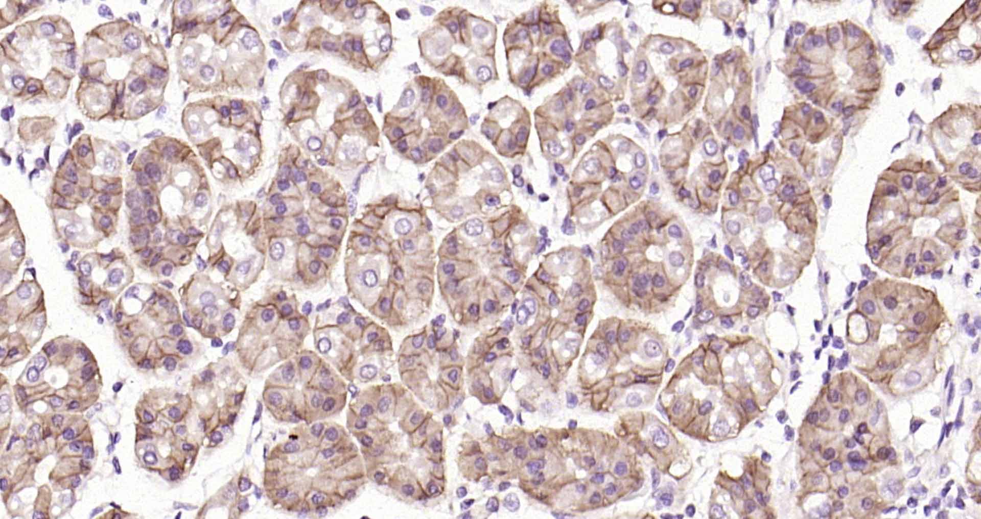 Claudin-18 Monoclonal Antibody