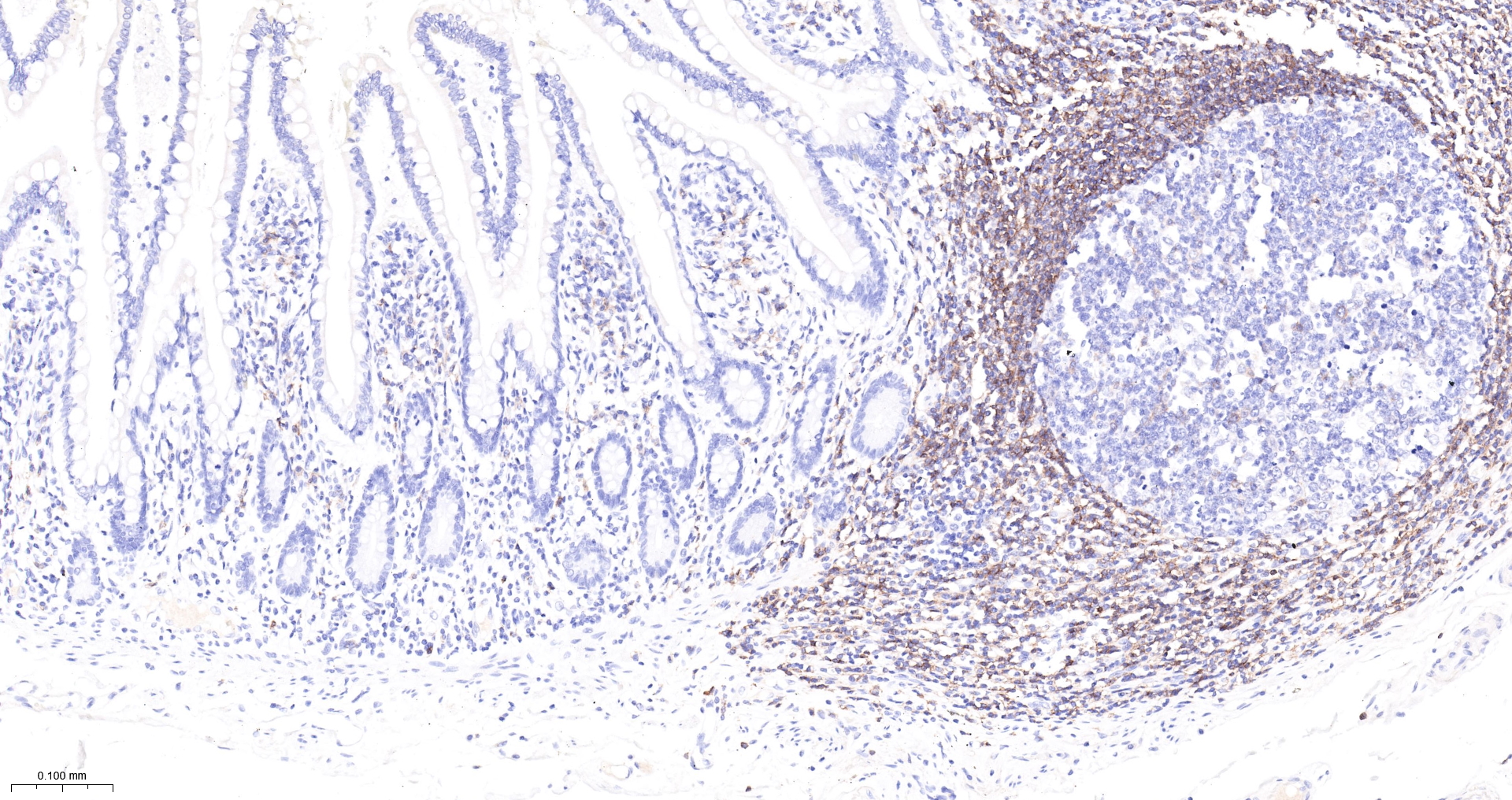 CD45RA Monoclonal Antibody