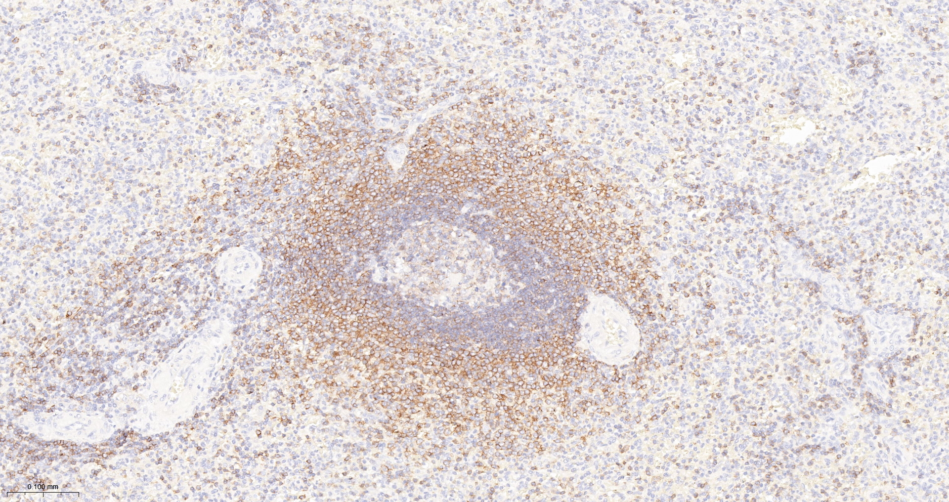 CD45RA Monoclonal Antibody