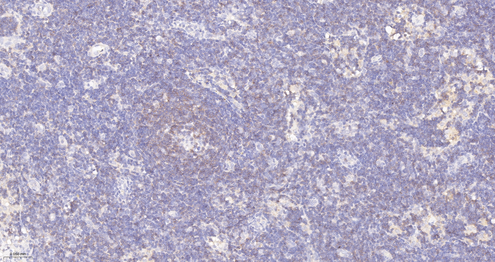 CD45RA Monoclonal Antibody