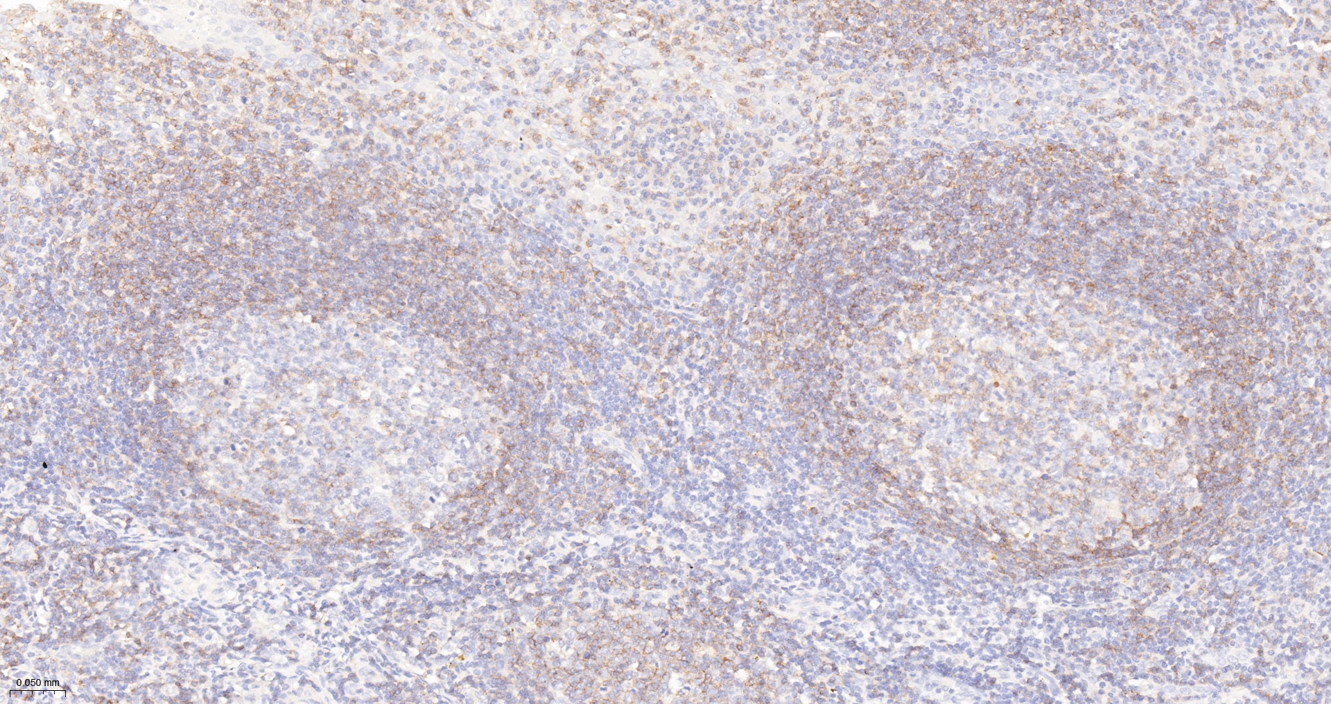 CD45RA Monoclonal Antibody