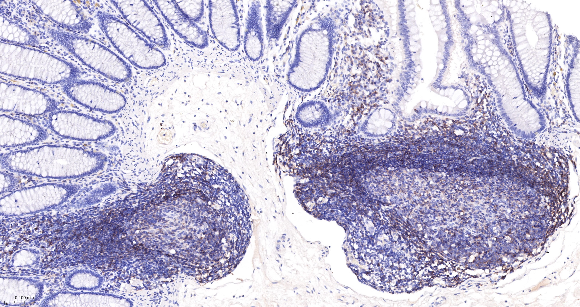 CD45RA Monoclonal Antibody