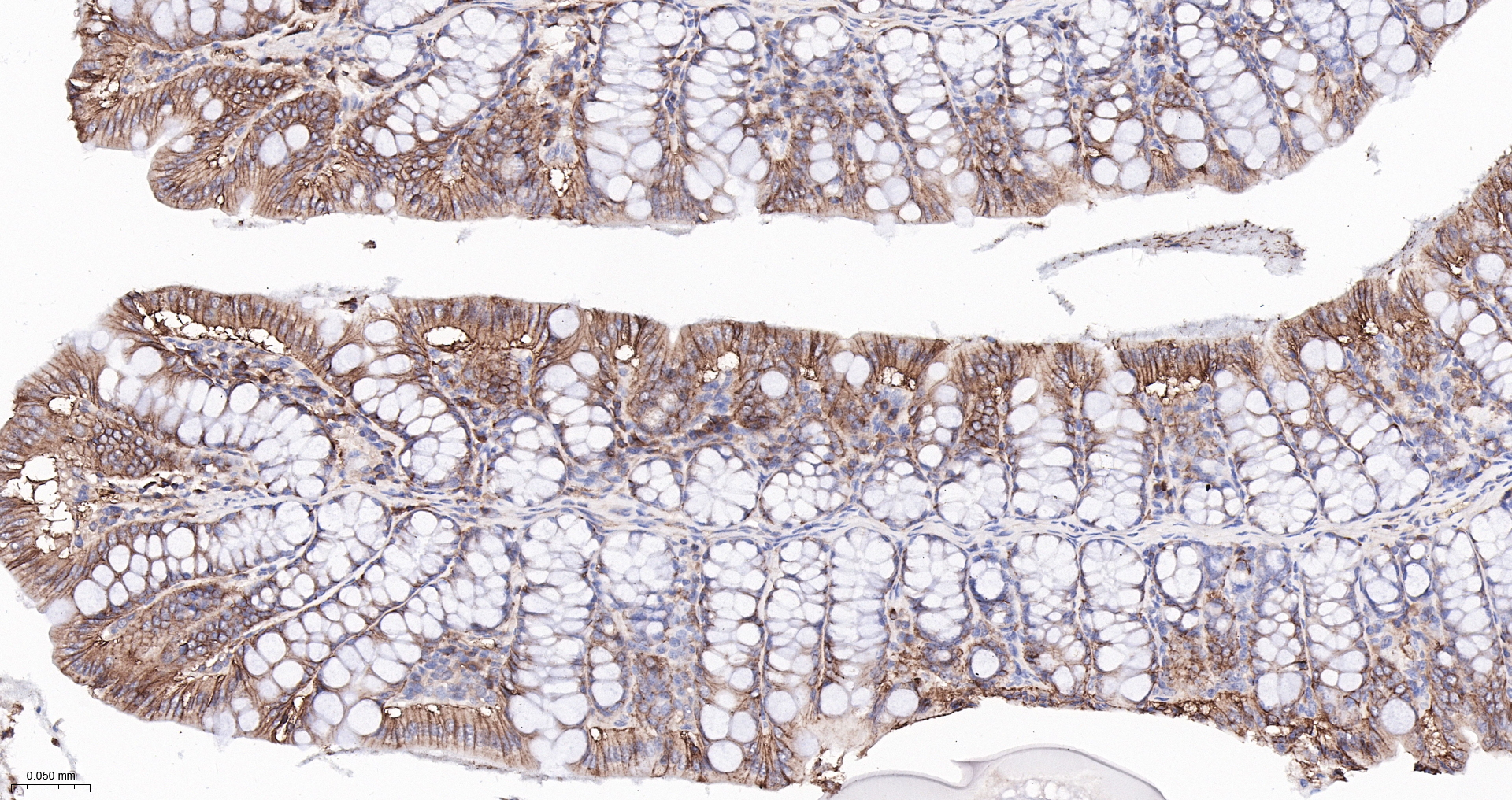 CLDN1 Monoclonal Antibody