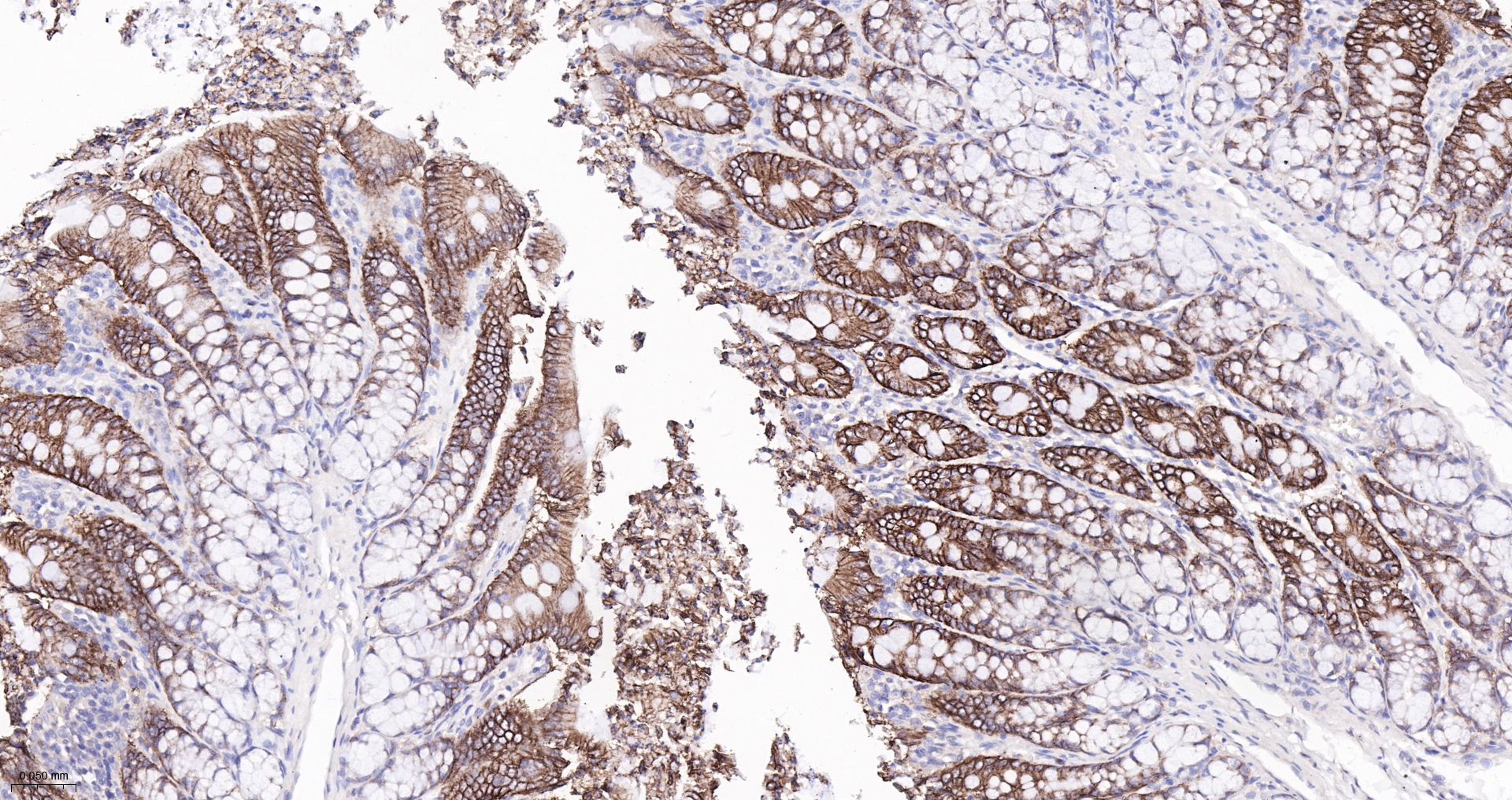 CLDN1 Monoclonal Antibody