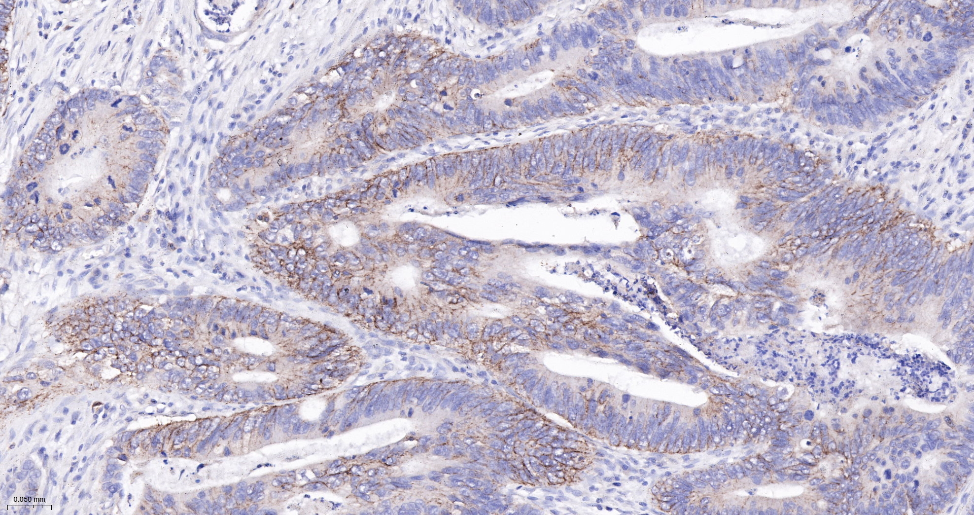 CLDN1 Monoclonal Antibody