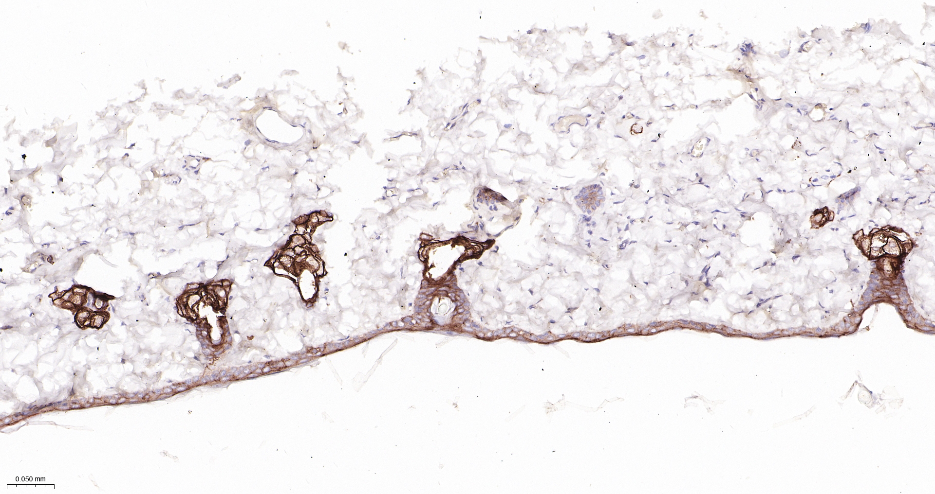 CLDN1 Monoclonal Antibody