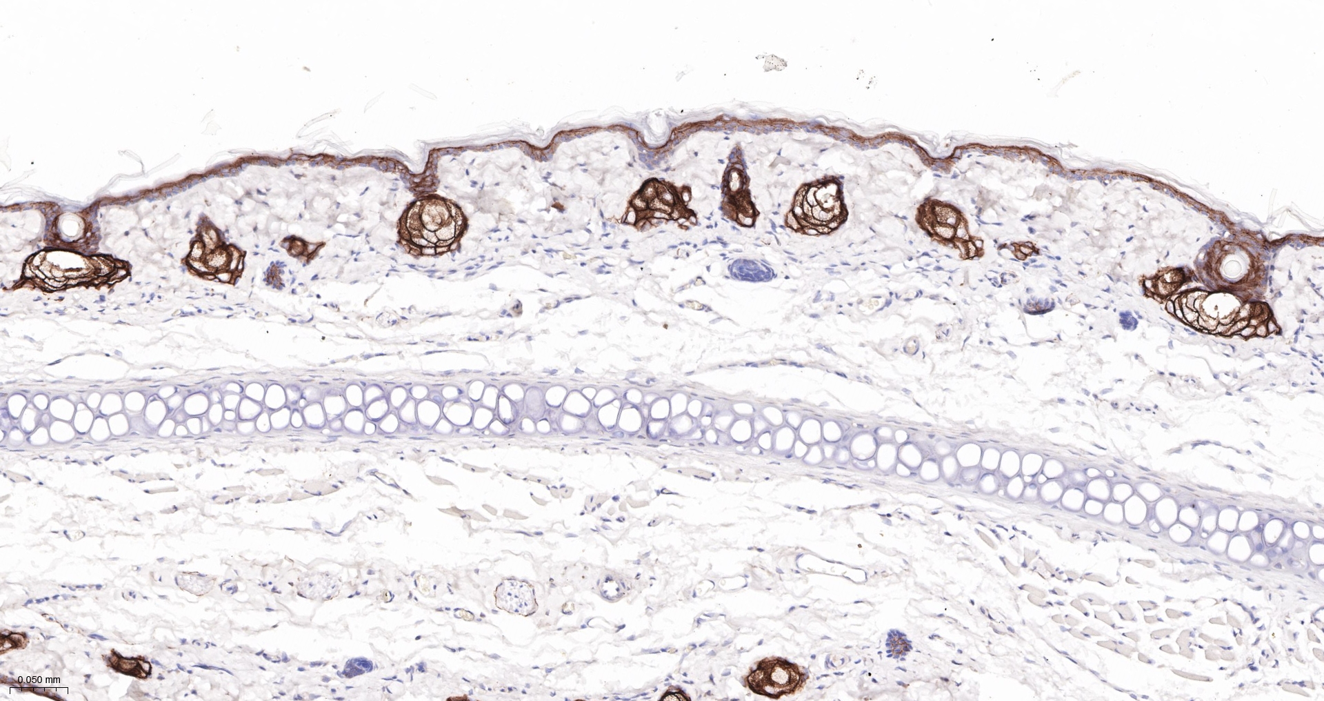 CLDN1 Monoclonal Antibody