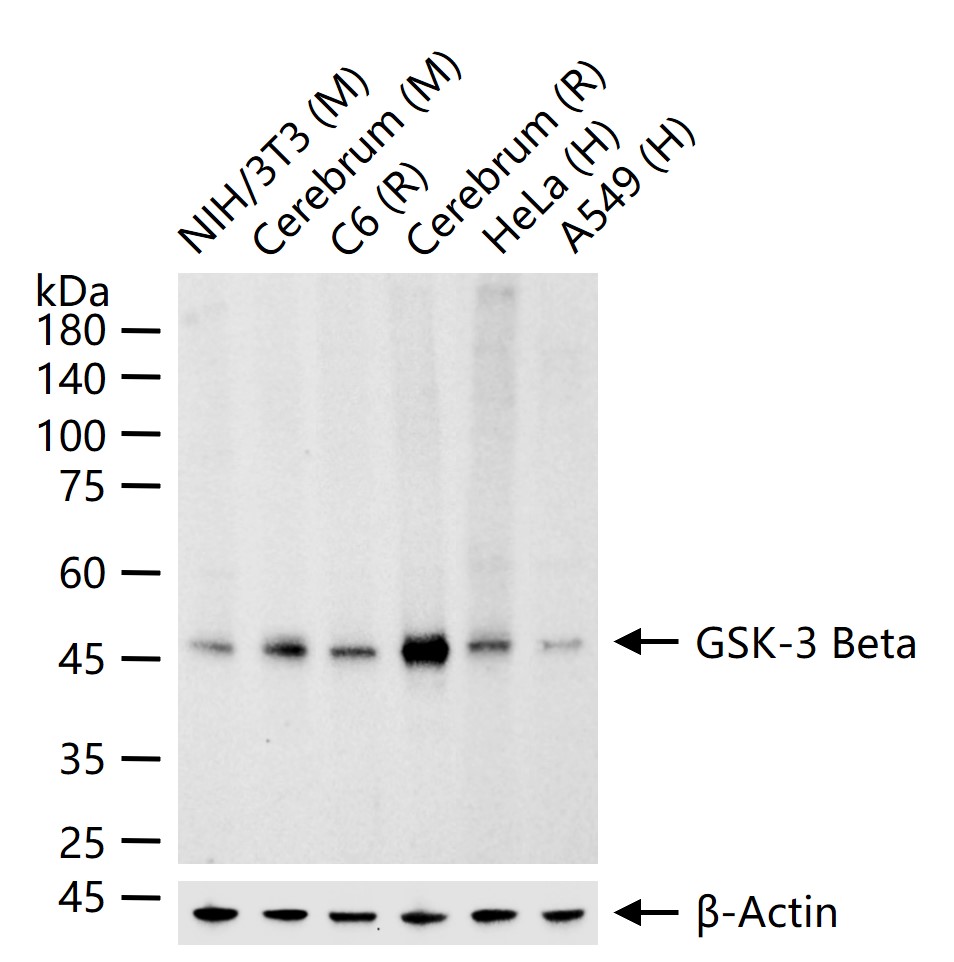 GSK-3 Beta Recombinant Antibody
