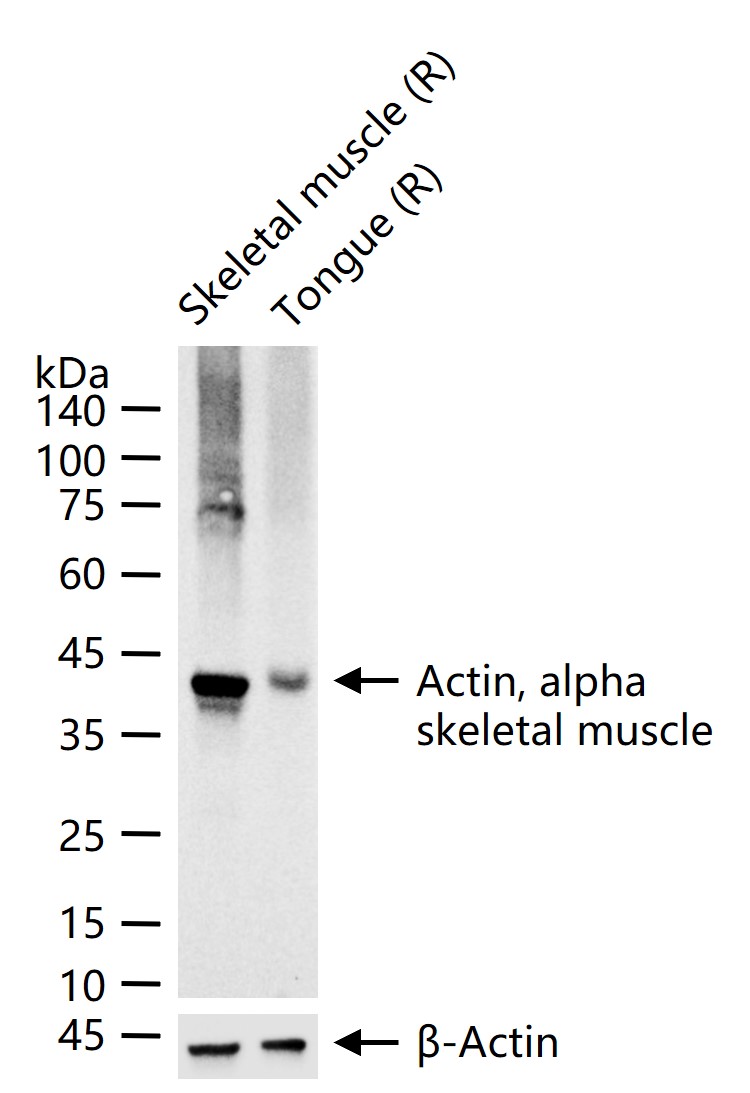 Actin, alpha skeletal muscle Recombinant Antibody