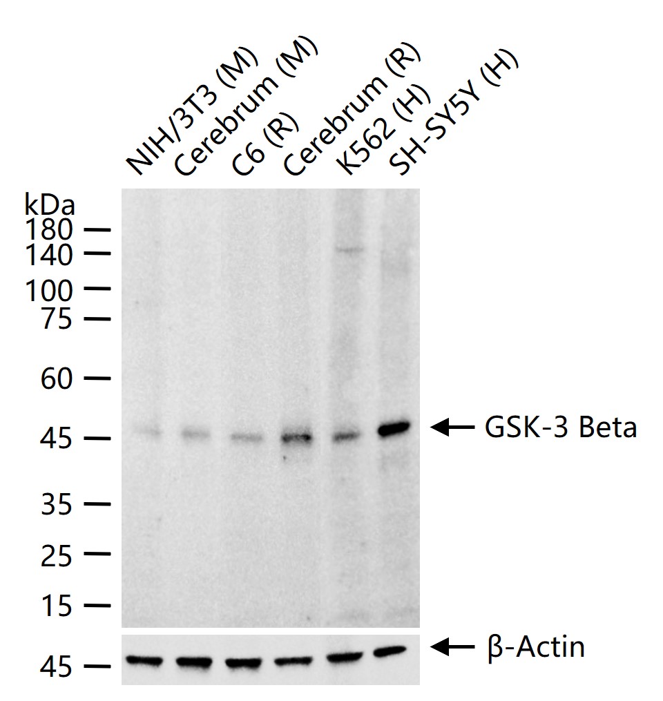 GSK-3 Beta Recombinant Antibody