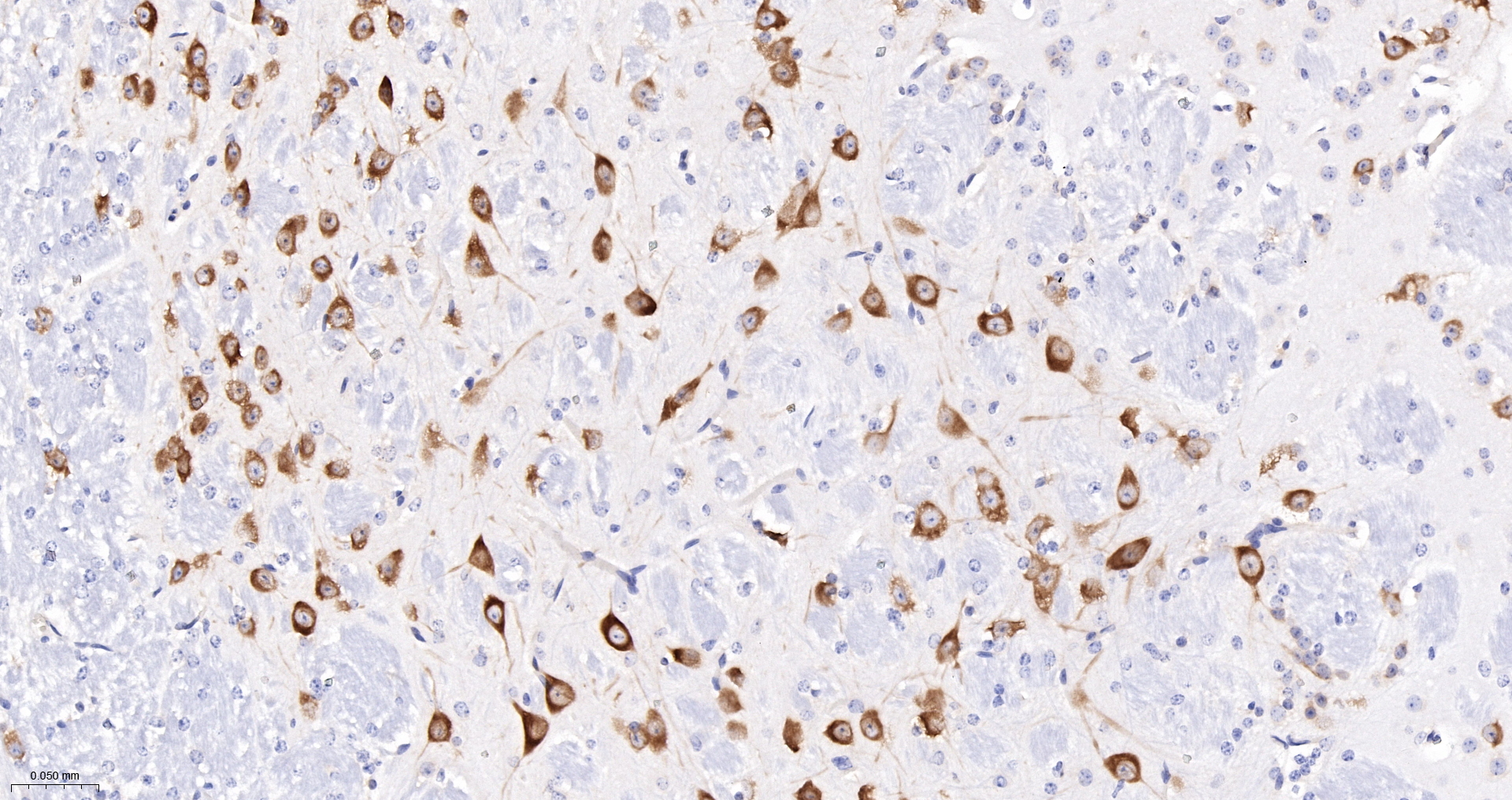 PRKRA Recombinant Antibody