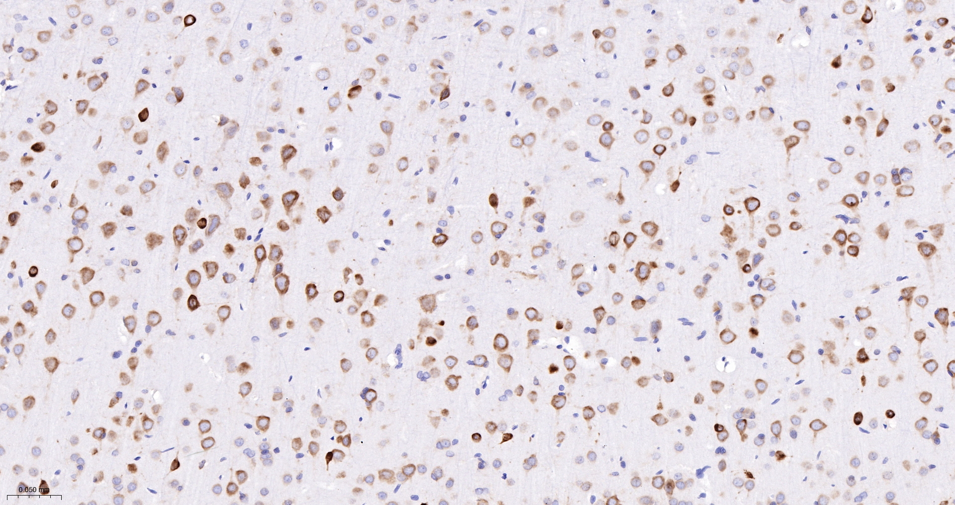 PRKRA Recombinant Antibody