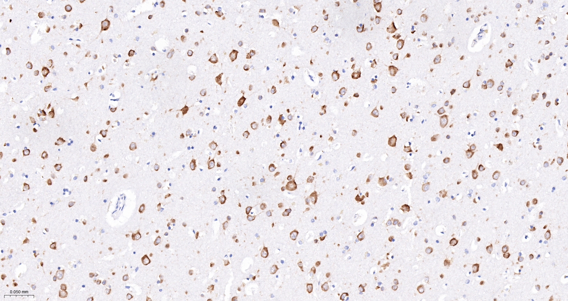 PRKRA Recombinant Antibody