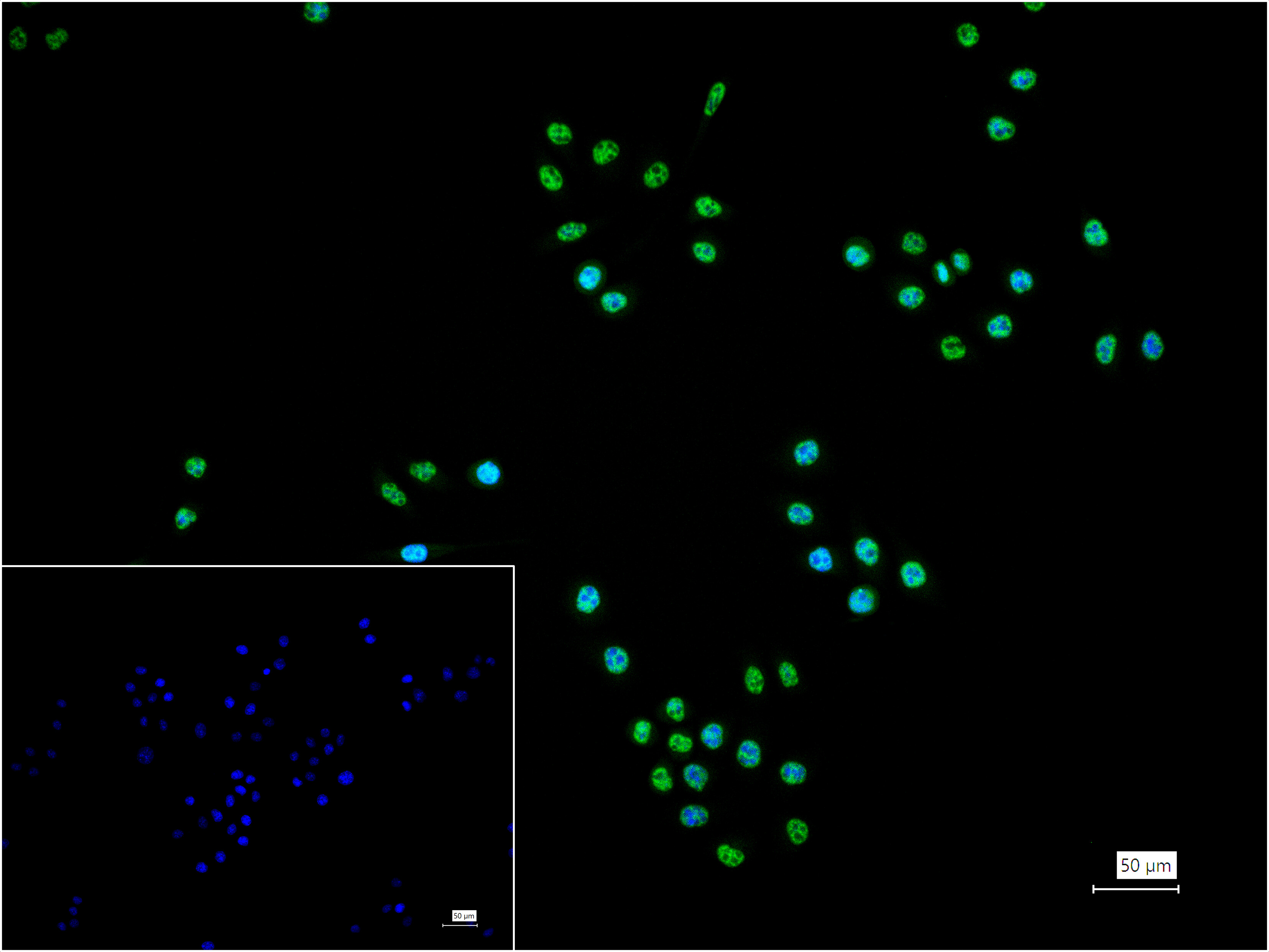 PABPN1 Monoclonal Antibody
