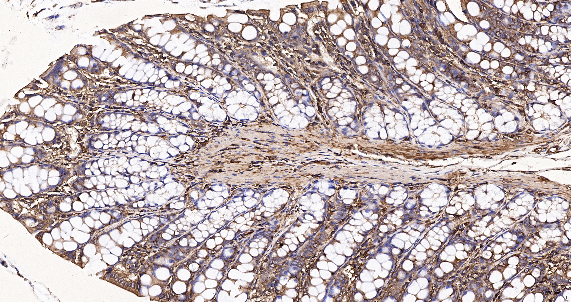 beta-Actin Recombinant Antibody, HRP Conjugated