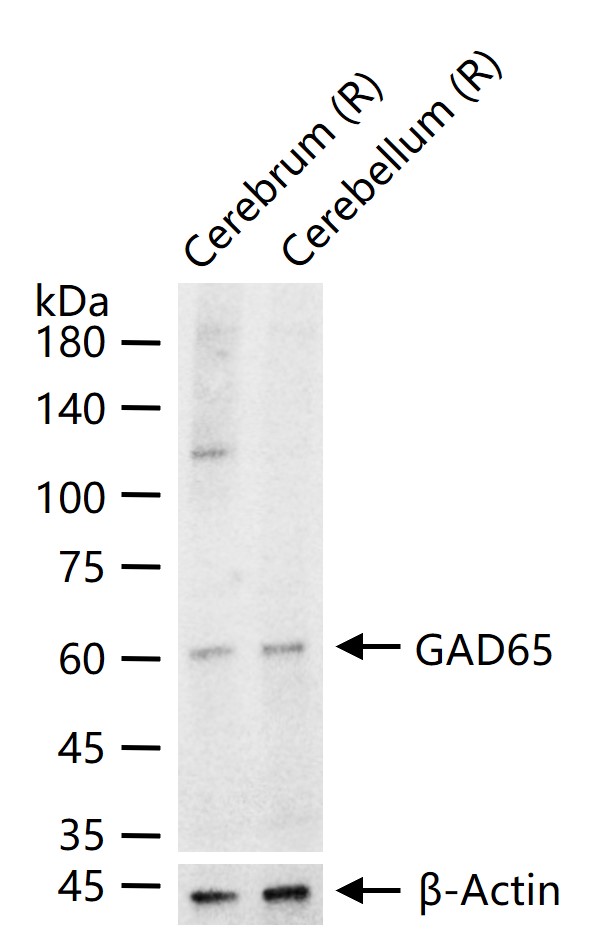 GAD65 Monoclonal Antibody