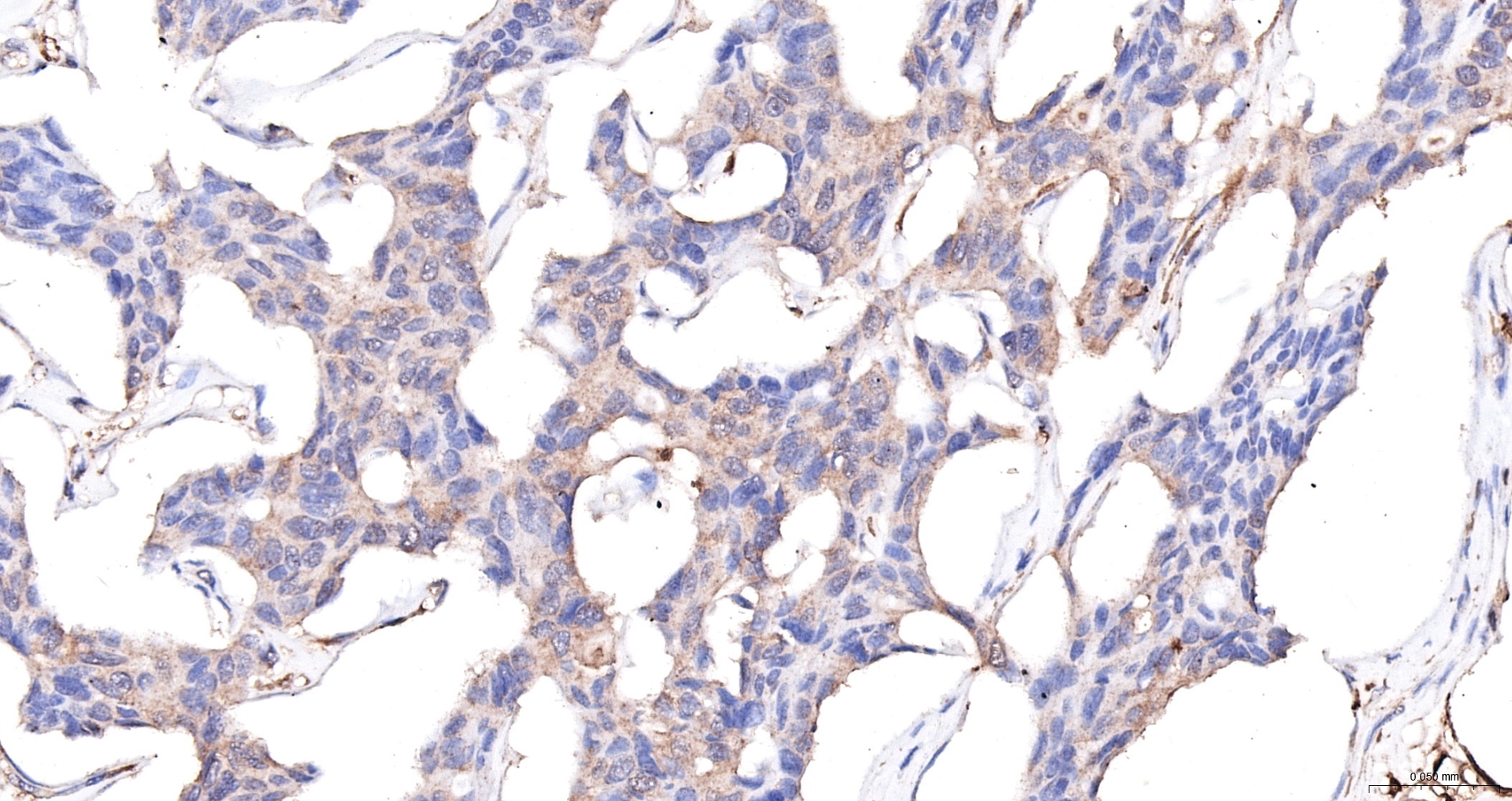JAK1 Monoclonal Antibody