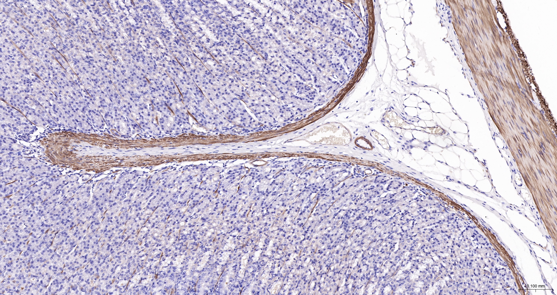CNN1 Recombinant Antibody, Biotin Conjugated